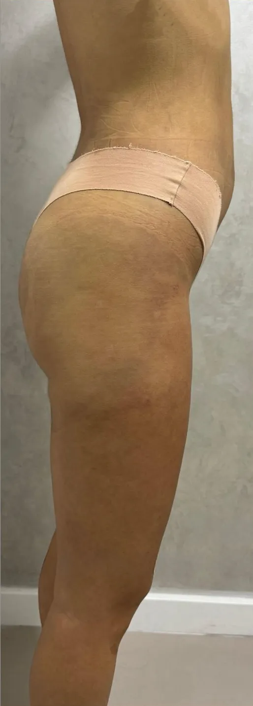 До трансформации